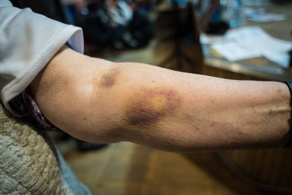 Głodowka-dobrzen-wielki-opole